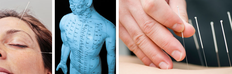 fm_project_iso_akupunktio